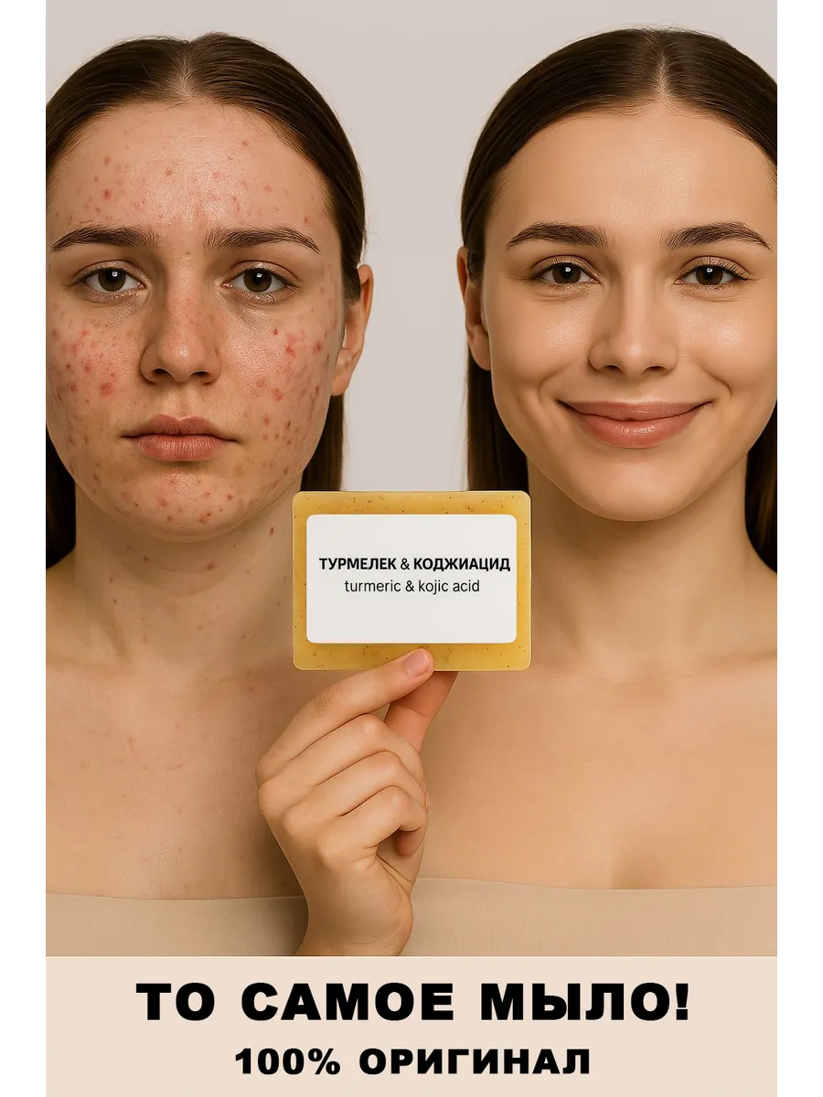 Мыло Коджиацид